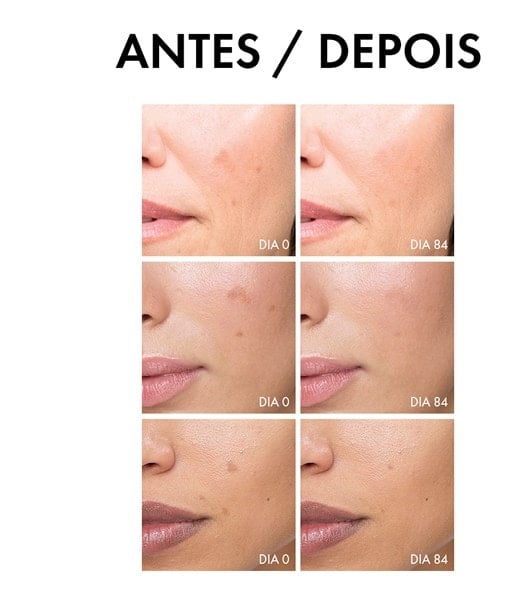 IFTACTIV VICHY LIFTACTIV PIGMENT SPECIALIST B3 30ML SÉRUM ANTIMANCHAS