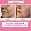 Sabonete Líquido Facial Acne Defense