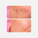 Sérum Fortalecedor Antioleosidade - Niacinamide B