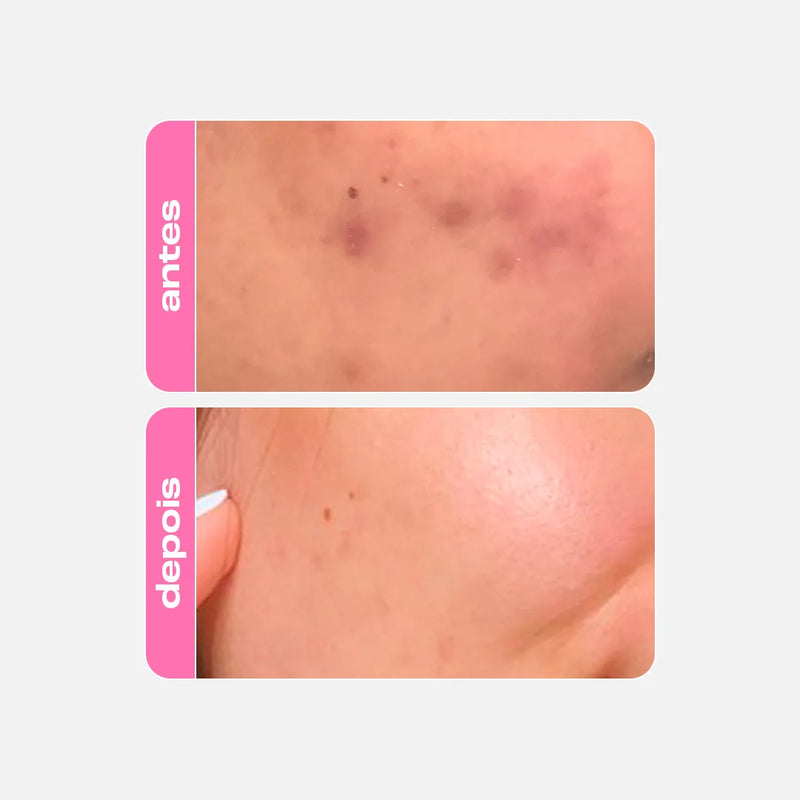 Sérum Fortalecedor Antioleosidade - Niacinamide B