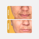 Sérum Antioxidante Clareador - Vitamina C Gold