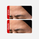 Sérum Facial Retinal 30g