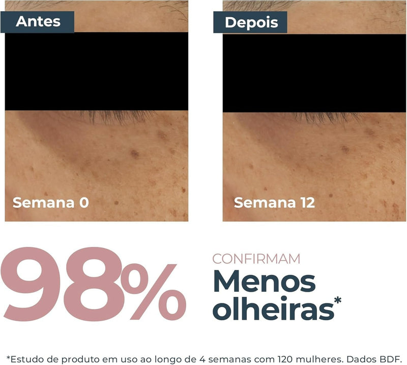 Anti-Pigment Creme Clareador de Olheiras 15 ml