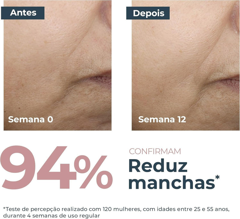 Anti-Pigment Creme Clareador Facial Dia FPS 30