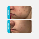 Ácido Glicólico – Creme Retexturizador